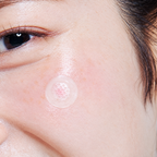 ACROPASS Blemish Care Microcone® Patch 8 szt