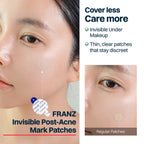 FRANZ Naked Dark Spot Patches 72szt | Science