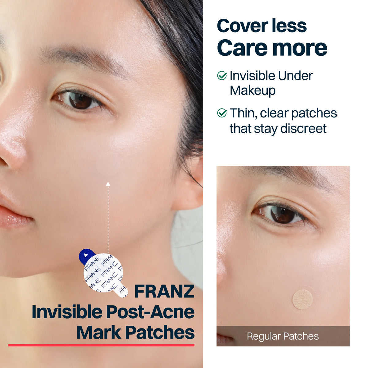 FRANZ Naked Early Spot Patches 72szt | Science