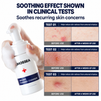Dr. MOSSEA Jinjung Foaming Cleanser | Ultradelikatne oczyszczanie skóry trądzikowej