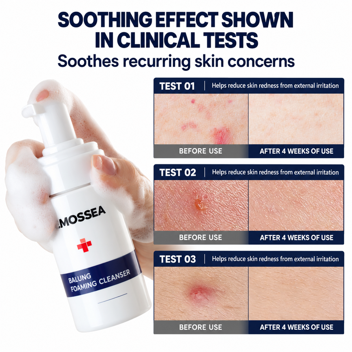 Dr. MOSSEA Jinjung Foaming Cleanser | Ultradelikatne oczyszczanie skóry trądzikowej