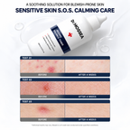 Dr. MOSSEA Jinjung Balance Toner 300ml | Kojąca pielęgnacja skóry trądzikowej
