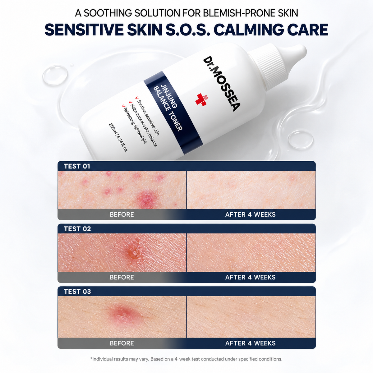 Dr. MOSSEA Jinjung Balance Toner 300ml | Kojąca pielęgnacja skóry trądzikowej