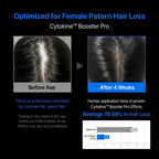 Refilled Hair Recovery Booster Pro Hair Tonic 70 ml I Pomaga łagodzić objawy wypadania włosów