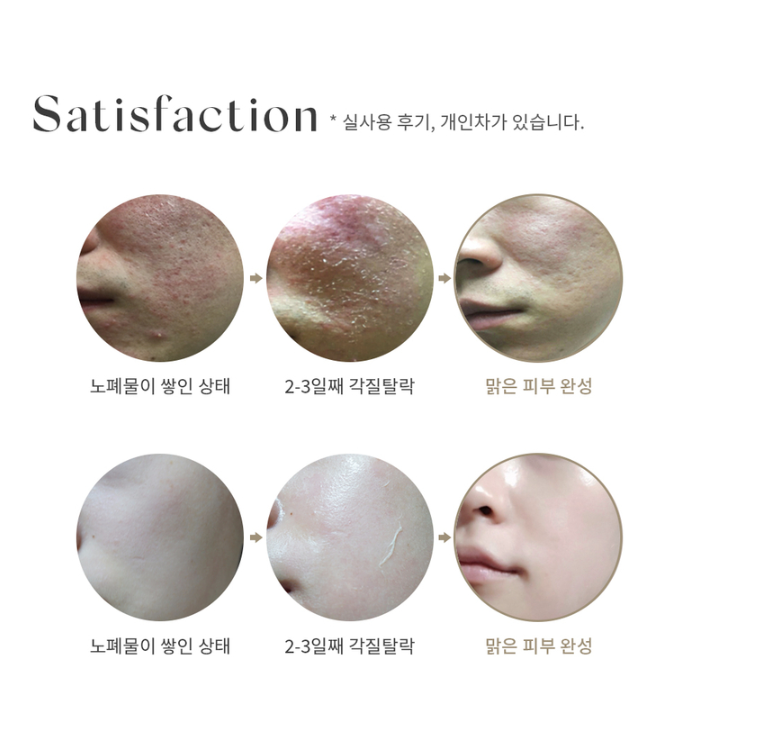BQCELL Derma Skin Peeling I Regenerująca ampułka peelingująca – wygładzenie i odnowa skóry