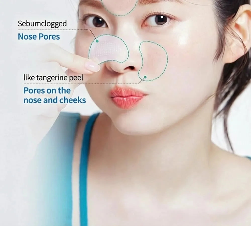 ACROPASS Pore Care Microcone® Patch 4 szt